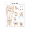 Chart of Hip and Knee