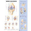 Chart of Knee Joint