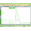 Electromyography Relaxation Training