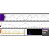 Heart Rate Variability