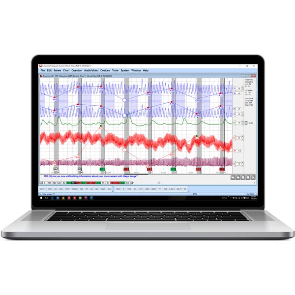 Polygraph Score Chart