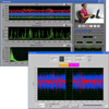 Electromyography (EMG) Analysis Software