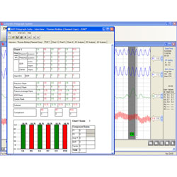 Polygraph Score Chart